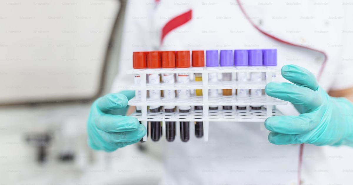 The AMH Test and Ovarian Reserve, Explained