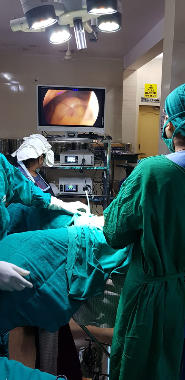 Laparoscopic surgery